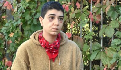 Beyoğlu’nda saldırı sonrası yüzü kısmi felç oldu