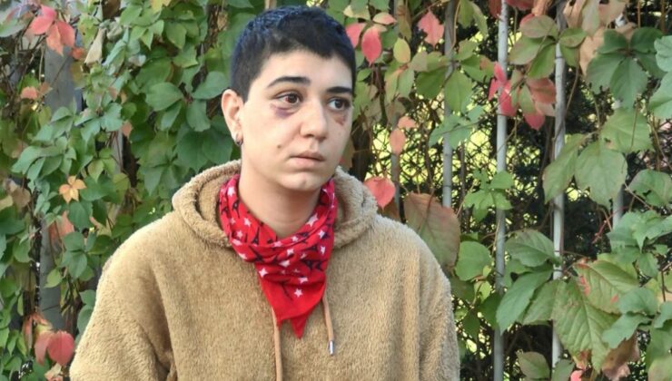 Beyoğlu’nda saldırı sonrası yüzü kısmi felç oldu