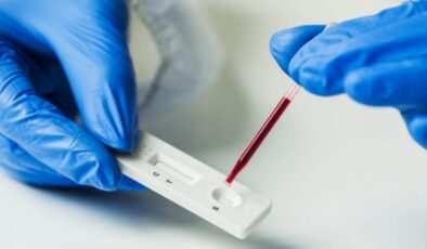 DSÖ, ilk kez bir koronavirüs antikor test kitine uluslararası lisans verdi