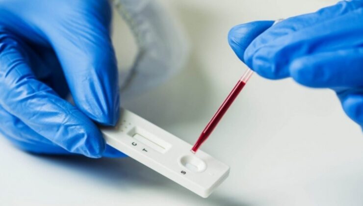 DSÖ, ilk kez bir koronavirüs antikor test kitine uluslararası lisans verdi
