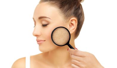 Kışın artan cilt lekelerini önlemenin 7 yolu