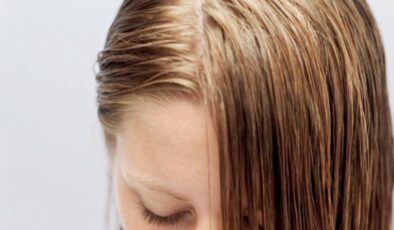 Yağlı saçlarla mücadele etmenin 5 yolu