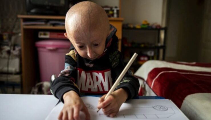 9 yaşındaki Veysel’in hayat mücadelesi