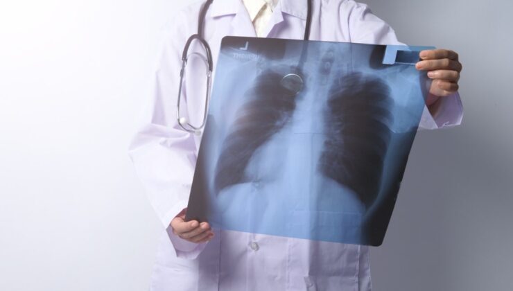 Akciğer kanserinin 5 erken belirtisi
