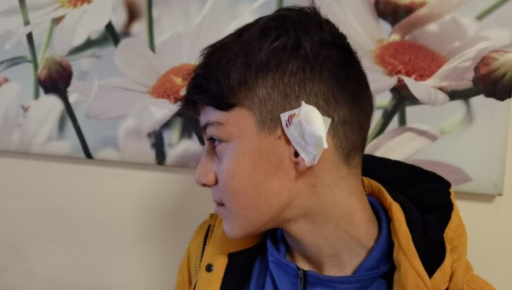 Bursa’da kartopu oynarken köpek saldırdı