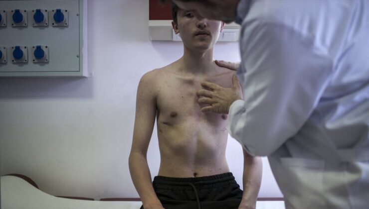 Ankara’da, kunduracı göğsü hastalığından kapalı ameliyat ile kurtuldu