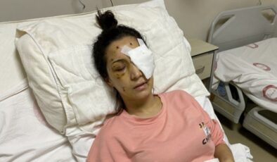 Hatay’da ağabey demedi diye, yengesini 37 yerinden bıçakladı